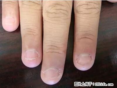 剪指甲、挖耳屎，这些日常小动作竟隐藏大危害！ - 博尔塔拉生活资讯 - 博尔塔拉28生活网 betl.28life.net